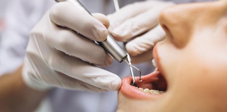 ¿Cada cuánto deberías hacerte una higiene dental