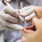Cada quant hauries de fer-te una higiene dental