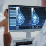 ¿Qué son las pruebas de detección del cáncer de mama?
