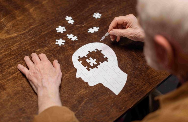 FC alzheimer