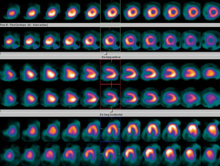 Unitat d'Imatge Cardiaca Corachan Barcelona