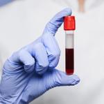 Tipos de sangre y compatibilidad