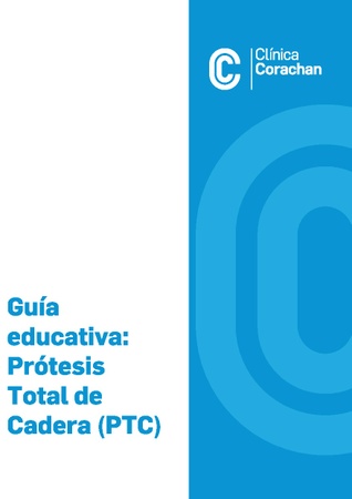 Guía educativa: Prótesis Total de Cadera (PTC)